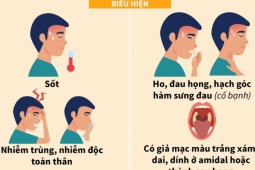 Sức khỏe đời sống - Bộ Y tế hướng dẫn phòng chống bệnh bạch hầu