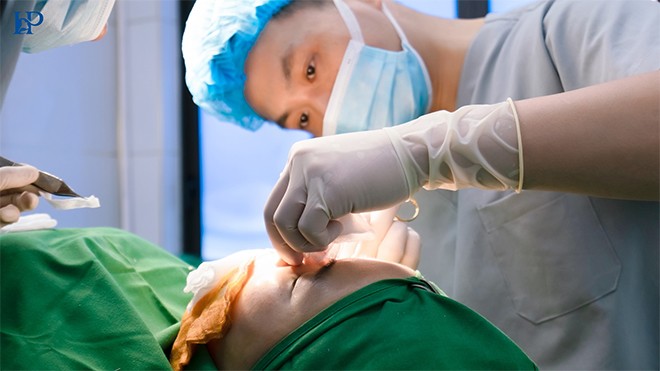 Thạc sĩ Bác sĩ Hữu Phước: Nâng sửa mũi hỏng và những rủi ro tiềm ẩn - Chia sẻ dưới góc nhìn chuyên gia - 3