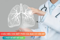 Tin tức sức khỏe - Làm sao để biết phổi của bạn có vấn đề - Xem ngay 4 dấu hiệu này