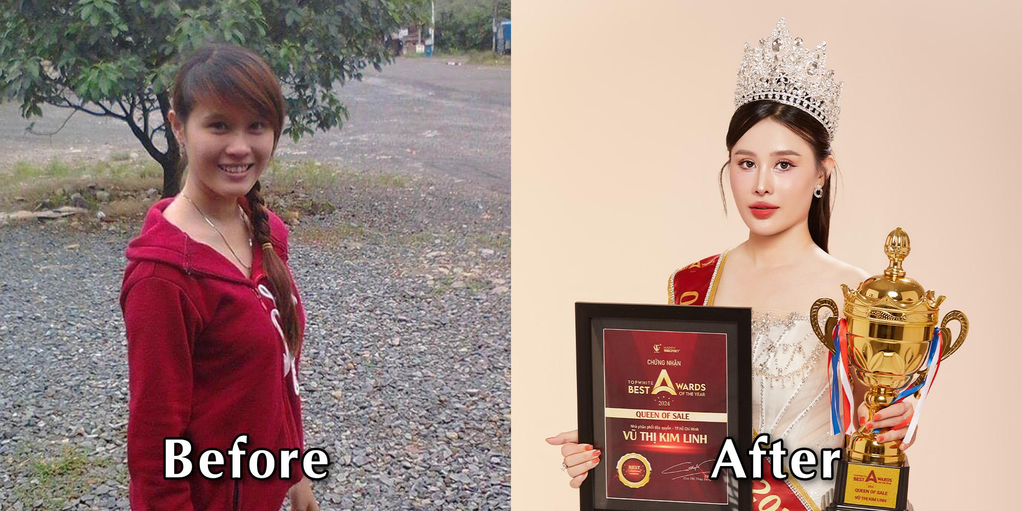 Nữ hoàng Sale Vũ Thị Kim Linh trước và sau khi trở thành NPP Top White.