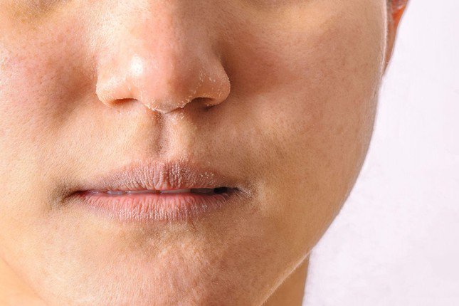 Để quạt thổi trực tiếp vào người có thể gây khô da, đau cổ vai gáy, khô mắt...