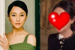 Làm đẹp - Nhan sắc biến dạng của "quốc bảo diễn xuất"