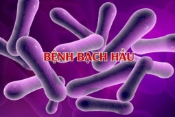 Bệnh bạch hầu lây truyền như thế nào và cách phòng tránh