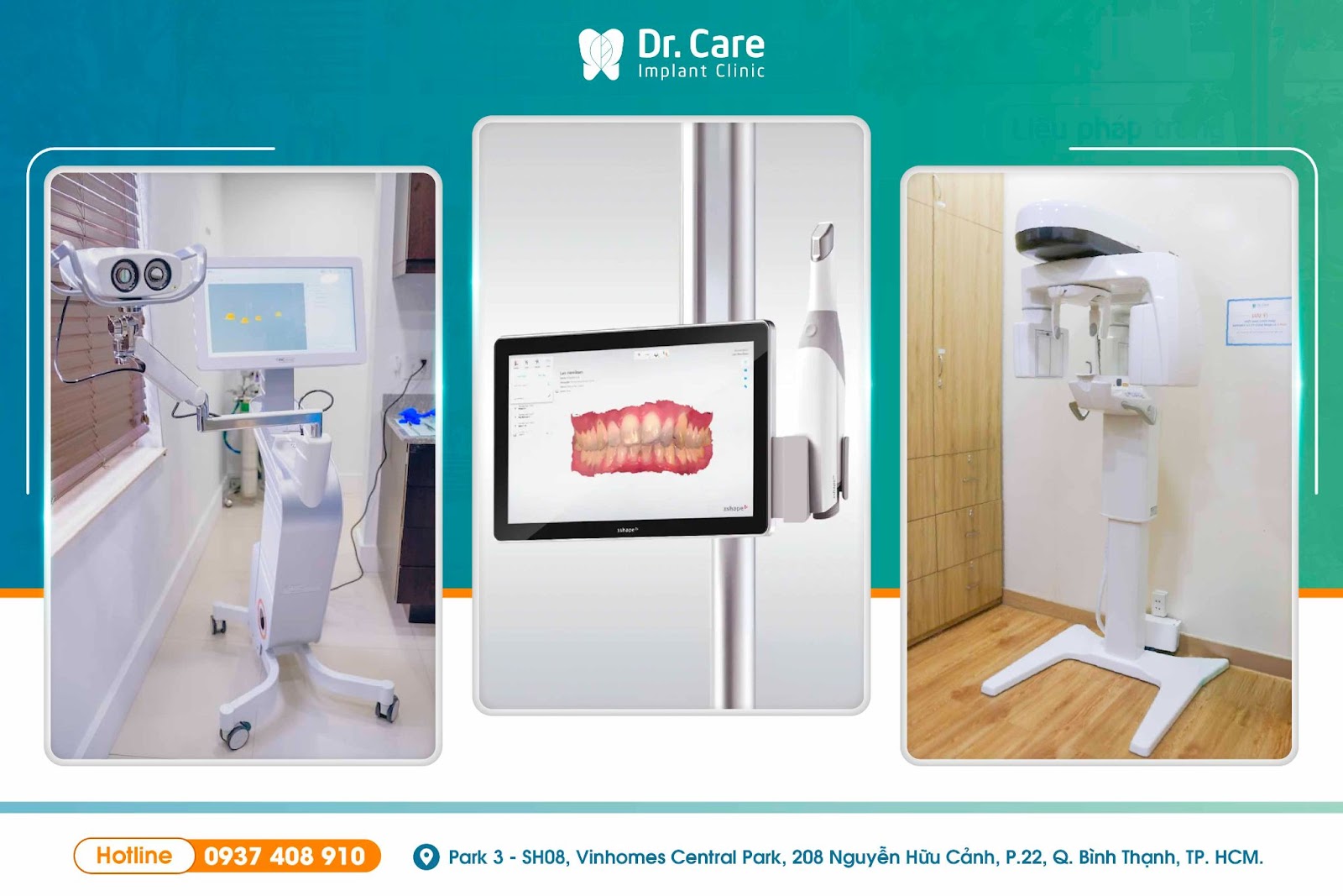 Nha khoa chuyên sâu trồng răng Implant tại TP.HCM dành cho người trung niên - 3