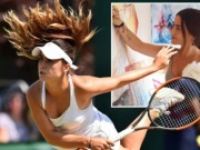 Mỹ nhân bỏ tennis khiến nước Anh tiếc nuối, từng nghi bị đầu độc ở Wimbledon