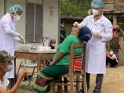 Sức khỏe đời sống - Bệnh bạch hầu có dễ lây nhiễm như COVID-19?