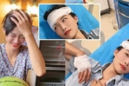 Bạn trẻ - Cuộc sống - Bị chấn động não vì 'bổ' dưa hấu bằng đầu