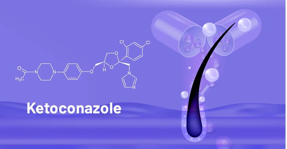 Nam giới nên chọn dầu gội chứa Ketoconazol để sạch gàu