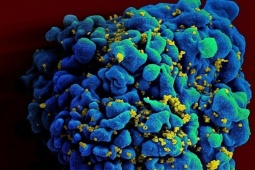 Người thứ 7 trên thế giới được chữa khỏi HIV