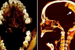 Phi thường - kỳ quặc - Cái chết đau đớn của xác ướp 'Người phụ nữ hét'