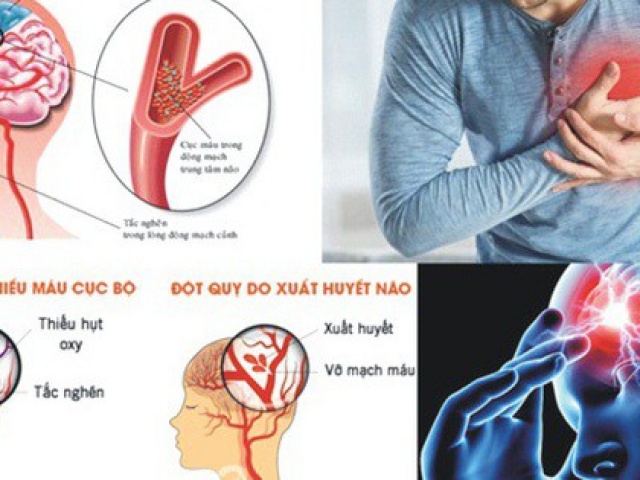 4 việc cần làm ngay khi ngủ dậy để phòng ngừa đột quỵ