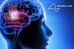 Công nghệ thông tin - Neuralink đã cấy ghép chip não cho bệnh nhân thứ hai
