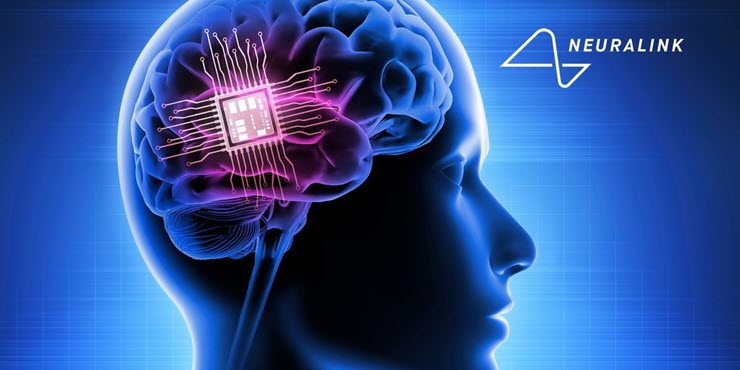 Neuralink đã thực hiện ca cấy ghép chip não thứ hai thành công.