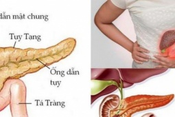 Sức khỏe đời sống - Người đàn ông ở Phú Thọ nhập viện gấp vì mỡ máu cao gấp 50 lần, bác sĩ khuyến cáo từ bỏ ngay thói quen này