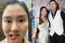 Đời sống Showbiz - Vợ diễn viên Xuân Phúc liệt một bên mặt