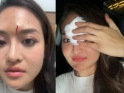 Đời sống Showbiz - Diễn viên Thùy Anh gặp tai nạn phim trường