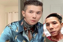 Kasim Hoàng Vũ sống vất vả vì bệnh tật, kinh doanh khó khăn