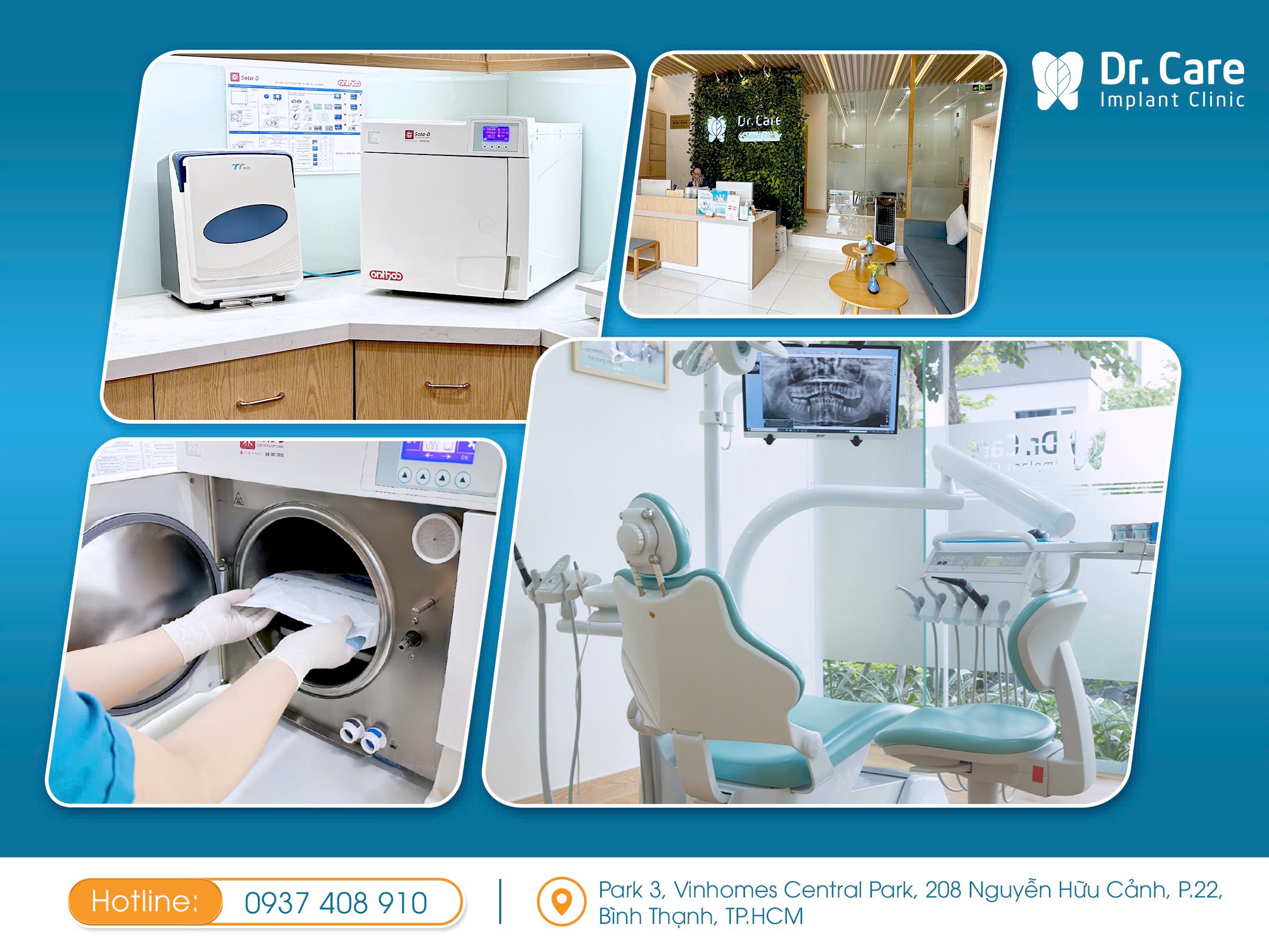 4 loại trụ Implant nên ưu tiên khi trồng răng Implant - 3