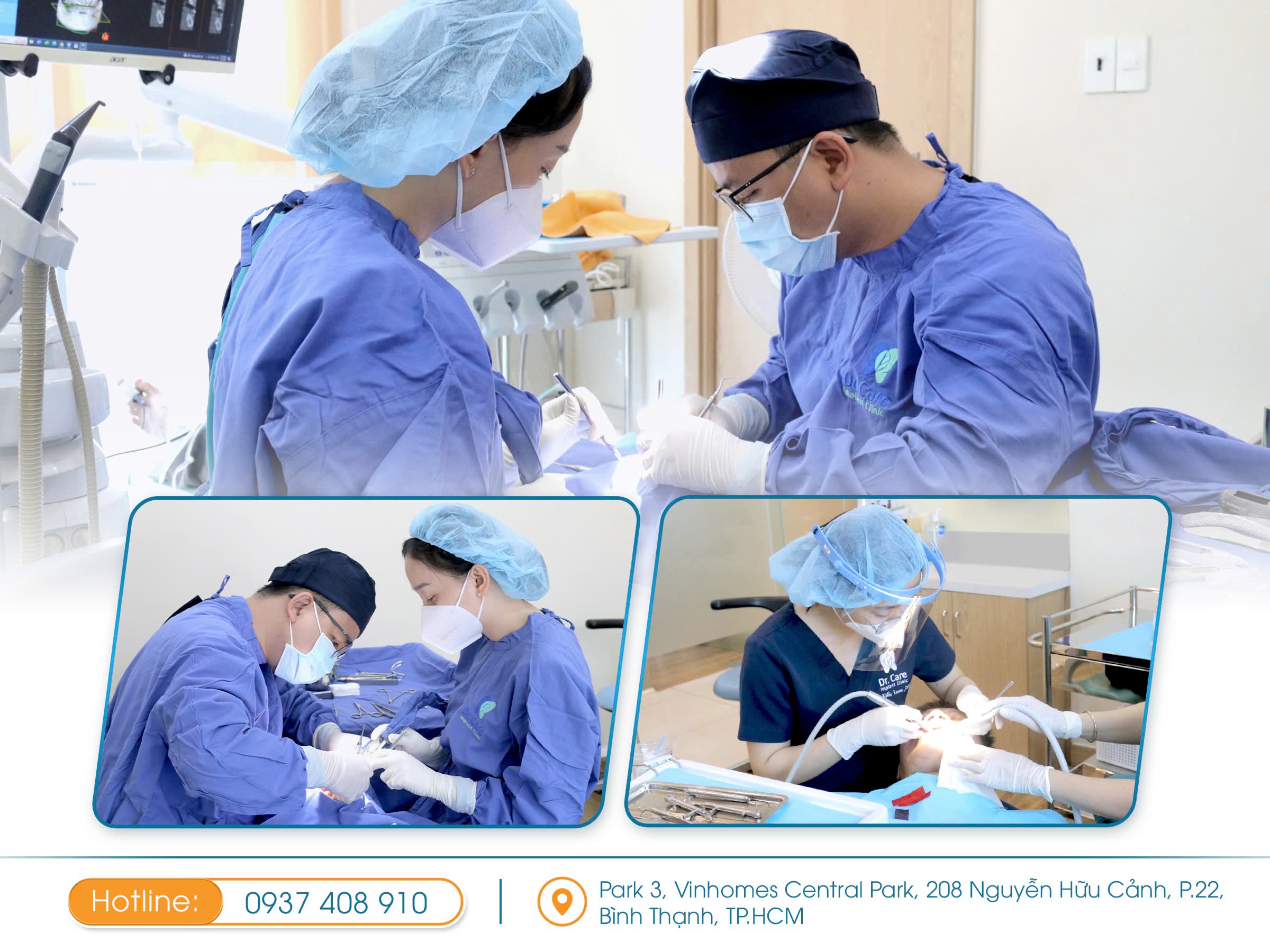 4 loại trụ Implant nên ưu tiên khi trồng răng Implant - 2