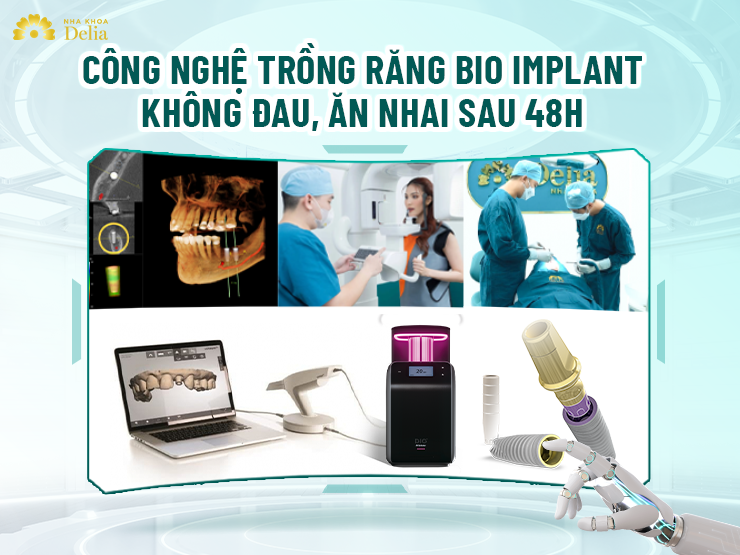 Bio Implant – Đột phá công nghệ trồng răng không đau, ăn nhai sau 48 giờ tại nha khoa Delia - 1