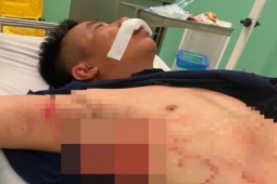 Thiếu tá công an bị chém trọng thương trong đêm