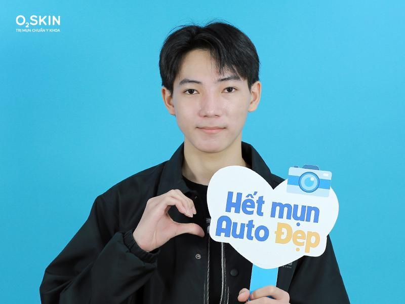 “Em thấy rất vui khi làn da ít mụn và trắng hơn sau khi điều trị tại O2 SKIN” Thanh Nhật hào hứng chia sẻ.