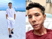 Đời sống Showbiz - Hiện trạng đáng lo về sức khỏe và tài chính của Kasim Hoàng Vũ