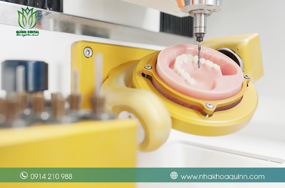 Quinn Dental – Nha khoa phục hình răng sứ uy tín tại Việt Nam - 6