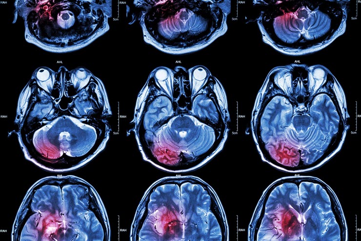 Dữ liệu fMRI có thể là yếu tố giúp hiện thực hóa việc ghi lại giấc mơ bằng AI.