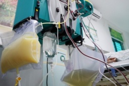 Người đàn ông 35 tuổi có máu đặc như sữa vì mắc bệnh này