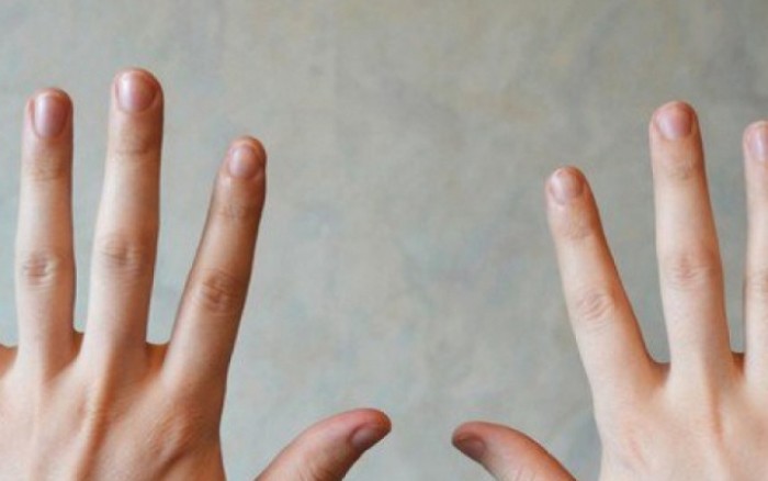 Nhìn móng tay để biết mình có bệnh hay không