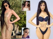 Làm đẹp - Nỗi thống khổ của cô gái chi một triệu USD để giống Kim Kardashian