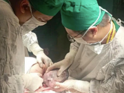 Sức khỏe đời sống - Giữa tâm bão lại điện mất, bác sĩ TTYT huyện phẫu thuật cứu thành công thai nhi bị suy tim thai