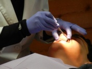 Sức khỏe đời sống - Người đàn ông tử vong sau khi nhổ 23 răng và trồng 12 răng trong 1 ngày