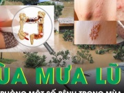 Sức khỏe đời sống - Cách phòng bệnh do vi khuẩn, ký sinh trùng trong mưa lũ, cần biết để tránh biến chứng nguy hiểm