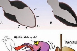 Sức khỏe đời sống - Điều gì xảy ra với trái tim khi bạn thất tình?