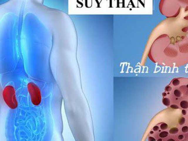 Có 3 dấu hiệu này, thanh niên 24 tuổi ở Phú Thọ đi khám bàng hoàng phát hiện suy thận giai đoạn cuối