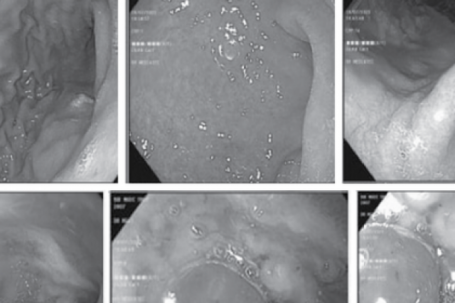 Nữ sinh 16 tuổi xuất huyết dạ dày thừa nhận thường xuyên làm việc này...