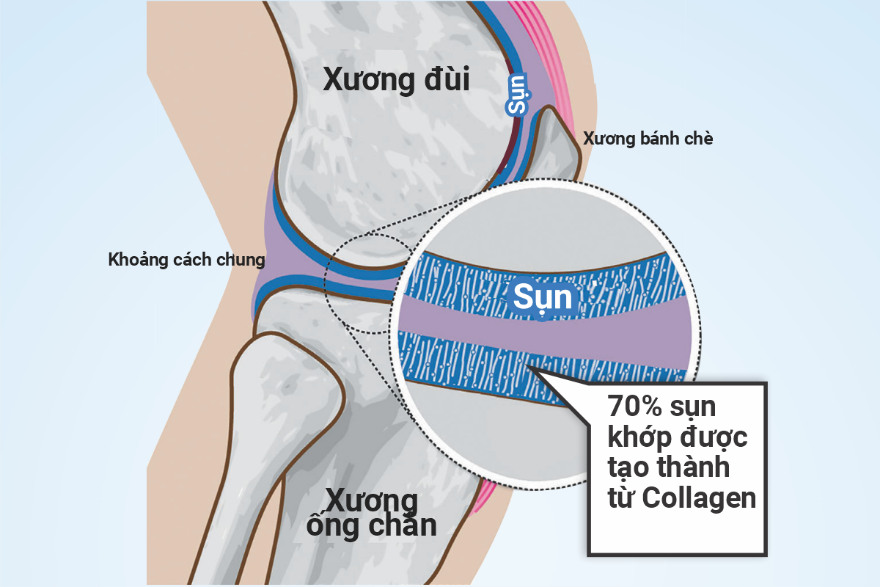 Collagen Peptides Type II - Chất căn bản có trong cấu trúc sụn khớp. Nguồn: Internet