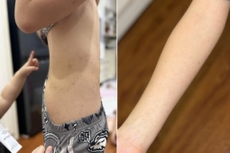 Chi gần 10 triệu đồng cho con đi trại hè 8 ngày, mẹ ở Hà Nội bức xúc khi đón con