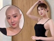 'Mỹ nhân chân đẹp nhất Đài Loan' suy sụp sau 6 lần hóa trị ung thư buồng trứng