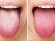 7 triệu chứng thầm lặng của ung thư đầu cổ