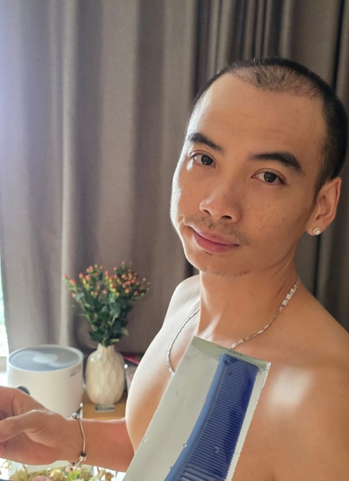 Các nang tóc vùng trán và đỉnh đầu của Tuấn Khôi hiện phát triển khỏe mạnh sau khi cấy nên được H'Hen Niê hài hước miêu tả 'như mấy cái đinh ba em đóng tôn ấy'.