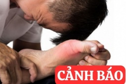 Tin tức sức khỏe - 6 thói quen tàn phá xương khớp tưởng vô hại nhưng cực nguy hiểm