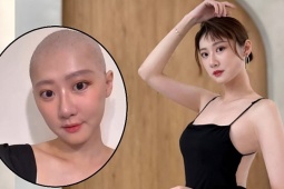  ' Mỹ nhân chân đẹp nhất Đài Loan '  suy sụp sau 6 lần hóa trị ung thư buồng trứng