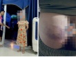 Làm rõ vụ học sinh bị cô giáo đánh nghi do làm nhầm bài tập