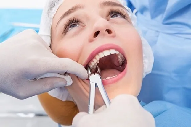 Bác sĩ sẽ thăm khám tổng quát răng miệng của bạn, chụp X - Quang để kiểm tra số lượng chân răng, hướng mọc, tình trạng các mô xung quanh. Căn cứ vào kết quả thăm khám, bác sĩ sẽ tư vấn cho bạn phương án phù hợp, nhổ đi hay giữ lại. Ảnh minh họa: Internet