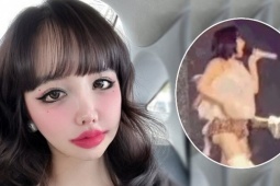 Park Bom gây sốc vì vòng ba bất thường