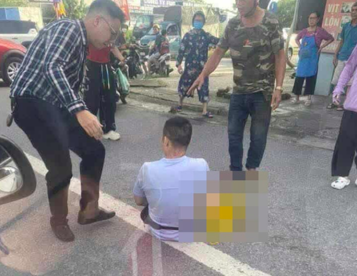 TikToker Hà List bị chém. Ảnh: Đ.X.