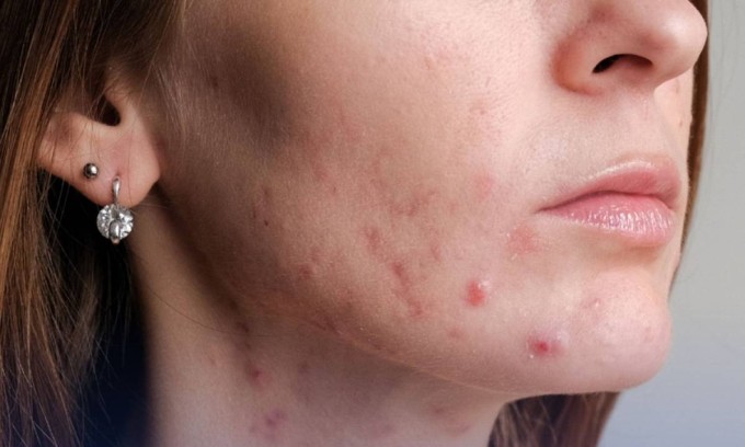 Ảnh: The Health Insider